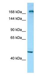 MYOM1 / Myomesin 1 Antibody - MYOM1 / Myomesin 1 antibody Western Blot of NCI-H226 cell lysate. MYOM1 is supported by BioGPS gene expression data to be expressed in NCIH226.  This image was taken for the unconjugated form of this product. Other forms have not been tested.
