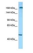 MYOM1 / Myomesin 1 Antibody - MYOM1 / Myomesin 1 antibody Western Blot of NCI-H226 cell lysate. MYOM1 is supported by BioGPS gene expression data to be expressed in NCIH226.  This image was taken for the unconjugated form of this product. Other forms have not been tested.