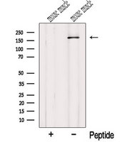 MYOM1 / Myomesin 1 Antibody - Western blot analysis of extracts of mouse muscle tissue using MYOM1-Specific antibody. The lane on the left was treated with blocking peptide.