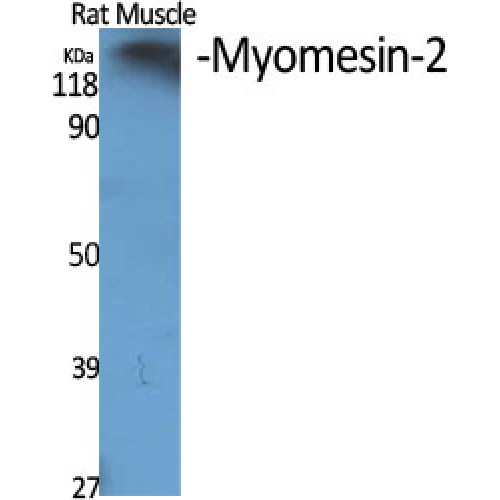 MYOM2 / Myomesin 2 Antibody - Western blot of Myomesin-2 antibody