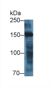 MYOM2 / Myomesin 2 Antibody - Western Blot; Sample: Porcine Heart lysate; Primary Ab: 1µg/ml Rabbit Anti-Human MYOM2 Antibody Second Ab: 0.2µg/mL HRP-Linked Caprine Anti-Rabbit IgG Polyclonal Antibody