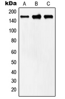 MYOM2 / Myomesin 2 Antibody - Western blot analysis of MYOM2 expression in human heart (A); mouse heart (B); rat heart (C) whole cell lysates.