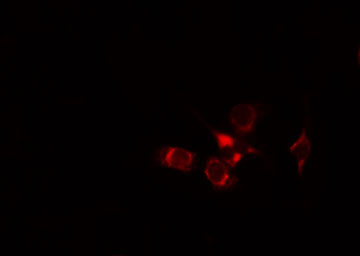 MYOM2 / Myomesin 2 Antibody - Staining HeLa cells by IF/ICC. The samples were fixed with PFA and permeabilized in 0.1% Triton X-100, then blocked in 10% serum for 45 min at 25°C. The primary antibody was diluted at 1:200 and incubated with the sample for 1 hour at 37°C. An Alexa Fluor 594 conjugated goat anti-rabbit IgG (H+L) antibody, diluted at 1/600, was used as secondary antibody.