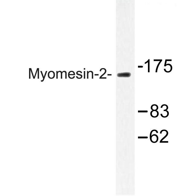 MYOM2 / Myomesin 2 Antibody - Western blot of Myomesin-2 (Y644) pAb in extracts from COS-7 cells.