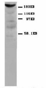 Myosin, Fast Skeletal Antibody -  This image was taken for the unconjugated form of this product. Other forms have not been tested.