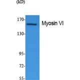 Myosin VI / MYO6 Antibody - Western blot of Myosin VI antibody