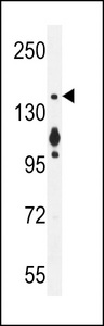 Myosin VI / MYO6 Antibody - MYO6 Antibody (C-term R1181) western blot of MCF-7 cell line lysates (35 ug/lane). The MYO6 antibody detected the MYO6 protein (arrow).