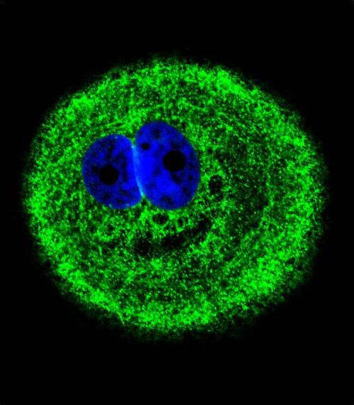 Myosin VI / MYO6 Antibody - Confocal immunofluorescence of MYO6 Antibody (C-term R1181)with MCF-7 cell followed by Alexa Fluor 488-conjugated goat anti-rabbit lgG (green). DAPI was used to stain the cell nuclear (blue).