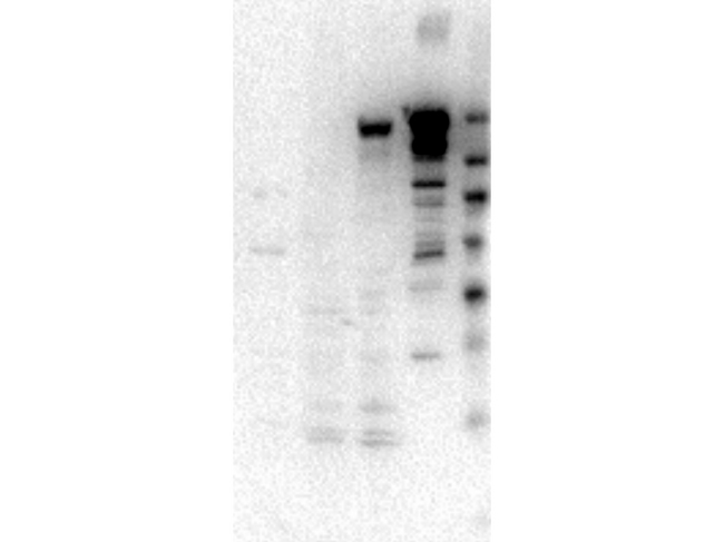Myosin VI / MYO6 Antibody - Western Blot of Rabbit anti-Myosin-6 antibody. Lane 1: SF9 cell lysate of truncated smooth myosin. Lane 2: Jurkat lysate. Lane 3: LnCap lysate. Lane 4: Recombinant myosin VI Load: 35 ug per lane for cell lysate. 50 ng of recombinant protein. Primary antibody: Myosin 6 antibody at 1:1000 for overnight at 4 degrees C. Secondary antibody: HRP rabbit secondary antibody at 1:40,000 for 60 min at RT. Block: 5% BLOTTO overnight at 4 degrees C. Predicted/Observed size: 150 kDa for Myo6.