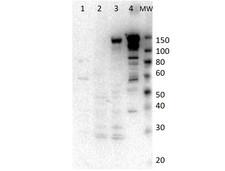 Myosin VI / MYO6 Antibody - Western Blot of rabbit anti-Myosin-6 antibody. Lane 1: SF9 cell lysate of truncated smooth myosin. Lane 2: Jurkat lysate. Lane 3: LnCap lysate. Lane 4: Recombinant myosin VI Load: 20µg per lane for cell lysate. 50ng of recombinant protein. Primary antibody: Myosin 6 antibody at 1:1000 for overnight at 4°C. Secondary antibody: HRP rabbit secondary antibody at 1:40,000 for 60 min at RT. Block: 5% BLOTTO overnight at 4°C. Predicted/Observed size: 150 kDa for Myo6.