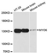Myosin VI / MYO6 Antibody - Western blot analysis of extracts of various cell lines, using MYO6 antibody at 1:3000 dilution. The secondary antibody used was an HRP Goat Anti-Rabbit IgG (H+L) at 1:10000 dilution. Lysates were loaded 25ug per lane and 3% nonfat dry milk in TBST was used for blocking. An ECL Kit was used for detection and the exposure time was 90s.