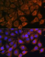 Myosin VI / MYO6 Antibody - Immunofluorescence analysis of HeLa cells using MYO6 Polyclonal Antibody at dilution of 1:100.Blue: DAPI for nuclear staining.