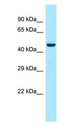 MYOT / Myotilin Antibody - MYOT / Myotilin antibody Western Blot of Fetal Liver.  This image was taken for the unconjugated form of this product. Other forms have not been tested.