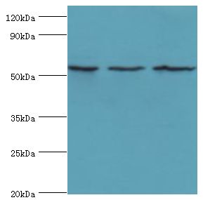 MYOT / Myotilin Antibody - Western blot. All lanes: MYOT antibody at 2 ug/ml. Lane 1: 293T whole cell lysate. Lane 2: HepG2 whole cell lysate. Lane 3: mouse skeletal muscle tissue. Secondary antibody: Goat polyclonal to rabbit at 1:10000 dilution. Predicted band size: 55 kDa. Observed band size: 55 kDa.