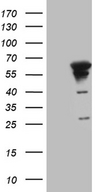 MYOT / Myotilin Antibody - HEK293T cells were transfected with the pCMV6-ENTRY control. (Left lane) or pCMV6-ENTRY MYOT. (Right lane) cDNA for 48 hrs and lysed. Equivalent amounts of cell lysates. (5 ug per lane) were separated by SDS-PAGE and immunoblotted with anti-MYOT. (1:2000)