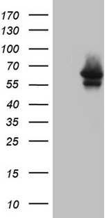 MYOT / Myotilin Antibody - HEK293T cells were transfected with the pCMV6-ENTRY control. (Left lane) or pCMV6-ENTRY MYOT. (Right lane) cDNA for 48 hrs and lysed. Equivalent amounts of cell lysates. (5 ug per lane) were separated by SDS-PAGE and immunoblotted with anti-MYOT. (1:2000)