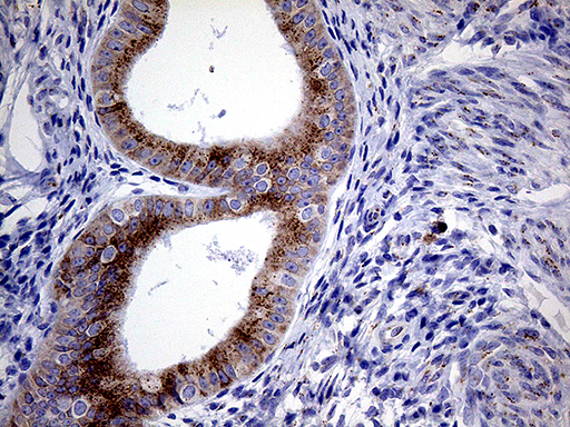MYOT / Myotilin Antibody - Immunohistochemical staining of paraffin-embedded Human endometrium tissue within the normal limits using anti-MYOT mouse monoclonal antibody. (Heat-induced epitope retrieval by 1mM EDTA in 10mM Tris buffer. (pH8.5) at 120°C for 3 min. (1:1000)
