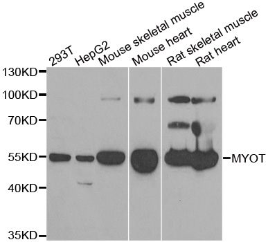 MYOT / Myotilin Antibody - Western blot analysis of extracts of various cell lines.