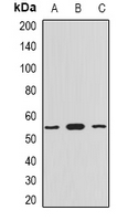 MYOT / Myotilin Antibody - Western blot analysis of Myotilin expression in HepG2 (A); mouse heart (B); rat heart (C) whole cell lysates.