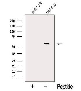 MYOT / Myotilin Antibody - Western blot analysis of extracts of mouse muscle tissue using MYOT antibody. The lane on the left was treated with blocking peptide.