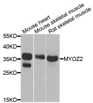 MYOZ2 / CS-1 Antibody - Western blot analysis of extracts of various cells.