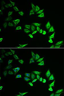 MYOZ2 / CS-1 Antibody - Immunofluorescence analysis of U2OS cells.