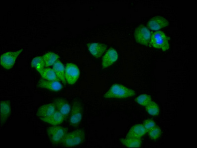 MYOZ2 / CS-1 Antibody - Immunofluorescence staining of Hela cells diluted at 1:100, counter-stained with DAPI. The cells were fixed in 4% formaldehyde, permeabilized using 0.2% Triton X-100 and blocked in 10% normal Goat Serum. The cells were then incubated with the antibody overnight at 4°C.The Secondary antibody was Alexa Fluor 488-congugated AffiniPure Goat Anti-Rabbit IgG (H+L).