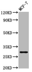 MYOZ2 / CS-1 Antibody - Western Blot Positive WB detected in: MCF-7 whole cell lysate All Lanes: MYOZ2 antibody at 4.31µg/ml Secondary Goat polyclonal to rabbit IgG at 1/50000 dilution Predicted band size: 30 KDa Observed band size: 30 KDa