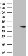 Myozenin / MYOZ1 Antibody - HEK293T cells were transfected with the pCMV6-ENTRY control. (Left lane) or pCMV6-ENTRY MYOZ1. (Right lane) cDNA for 48 hrs and lysed. Equivalent amounts of cell lysates. (5 ug per lane) were separated by SDS-PAGE and immunoblotted with anti-MYOZ1. (1:2000)