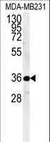 Myozenin / MYOZ1 Antibody - Western blot of MYOZ1 Antibody in MDA-MB231 cell line lysates (35 ug/lane). MYOZ1 (arrow) was detected using the purified antibody.