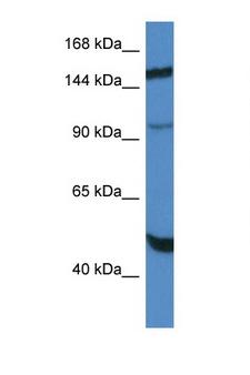 MYPN Antibody - MYPN antibody Western blot of HepG2 Cell lysate. Antibody concentration 1 ug/ml.  This image was taken for the unconjugated form of this product. Other forms have not been tested.