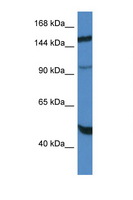 MYPN Antibody - MYPN antibody Western blot of HepG2 Cell lysate. Antibody concentration 1 ug/ml.  This image was taken for the unconjugated form of this product. Other forms have not been tested.