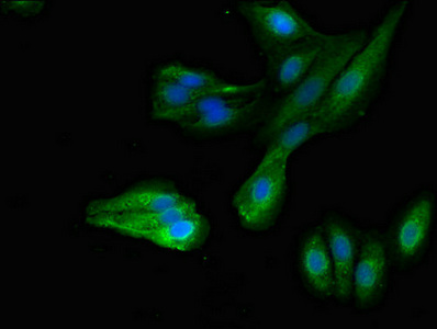 MYRIP Antibody - Immunofluorescent analysis of HepG2 cells diluted at 1:100 and Alexa Fluor 488-congugated AffiniPure Goat Anti-Rabbit IgG(H+L)
