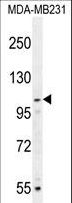 MYSM1 Antibody - MYSM1 Antibody western blot of MDA-MB231 cell line lysates (35 ug/lane). The MYSM1 antibody detected the MYSM1 protein (arrow).