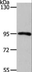 MYSM1 Antibody - Western blot analysis of Mouse kidney tissue, using MYSM1 Polyclonal Antibody at dilution of 1:1100.