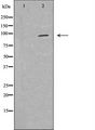 MYSM1 Antibody - Western blot analysis of HeLa cell lysates using MYSM1 antibody. The lane on the left is treated with the antigen-specific peptide.