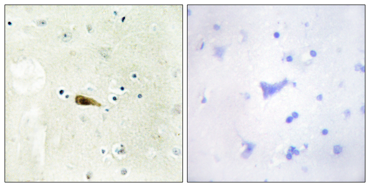 MYST1 Antibody - Immunohistochemistry analysis of paraffin-embedded human brain tissue, using MYST1 Antibody. The picture on the right is blocked with the synthesized peptide.