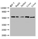 MYST1 Antibody - Positive WB detected in:MCF-7 whole cell lysate,HepG2 whole cell lysate,Jurkat whole cell ltysate,Mouse liver tissue,Rat liver tissue;All lanes:KAT8 antibody at 3?g/ml;Secondary;Goat polyclonal to rabbit IgG at 1/50000 dilution;Predicted band size:53,54 KDa;Observed band size: 53 KDa;