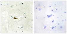 MYST1 Antibody - Peptide - + Immunohistochemistry analysis of paraffin-embedded human brain tissue, using MYST1 antibody.