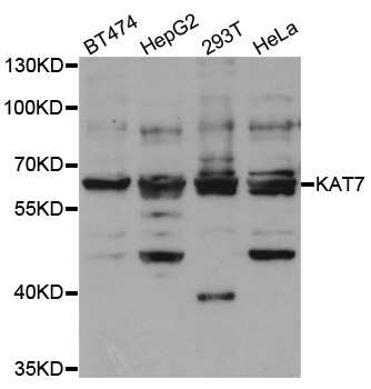 MYST2 / HBO1 Antibody - Western blot analysis of extracts of various cell lines.
