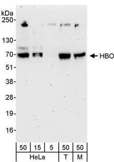 MYST2 / HBO1 Antibody - Detection of Human and Mouse HBO by Western Blot. Samples: Whole cell lysate from HeLa (5, 15 and 50 ug), 293T (T; 50 ug) and mouse NIH3T3 (M; 50 ug) cells. Antibodies: Affinity purified rabbit anti-HBO antibody used for WB at 0.04 ug/ml. Detection: Chemiluminescence with an exposure time of 3 minutes.