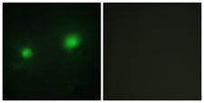 MYST2 / HBO1 Antibody - Immunofluorescence analysis of HUVEC cells, using MYST2 Antibody. The picture on the right is blocked with the synthesized peptide.