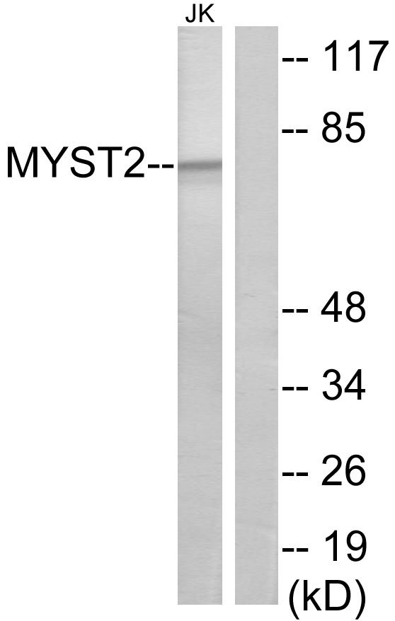MYST2 / HBO1 Antibody - Western blot analysis of lysates from Jurkat cells, using MYST2 Antibody. The lane on the right is blocked with the synthesized peptide.