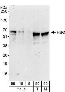 MYST2 / HBO1 Antibody - Detection of Human and Mouse HBO by Western Blot. Samples: Whole cell lysate from HeLa (5, 15 and 50 ug), 293T (T; 50 ug) and mouse NIH3T3 (M; 50 ug)cells. Antibodies: Affinity purified rabbit anti-HBO antibody used for WB at 0.4 ug/ml. Detection: Chemiluminescence with an exposure time of 3 minutes.