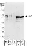 MYST2 / HBO1 Antibody - Detection of Human and Mouse HBO by Western Blot. Samples: Whole cell lysate from HeLa (5, 15 and 50 ug), 293T (T; 50 ug) and mouse NIH3T3 (M; 50 ug)cells. Antibodies: Affinity purified rabbit anti-HBO antibody used for WB at 0.4 ug/ml. Detection: Chemiluminescence with an exposure time of 3 minutes.