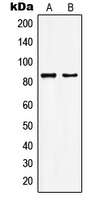 MYST2 / HBO1 Antibody - Western blot analysis of KAT7 expression in HepG2 (A); MCF7 (B) whole cell lysates.