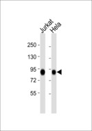MYST2 / HBO1 Antibody - All lanes : Anti-KAT7 Antibody at 1:1000 dilution Lane 1: Jurkat whole cell lysates Lane 2: HeLa whole cell lysates Lysates/proteins at 20 ug per lane. Secondary Goat Anti-Rabbit IgG, (H+L),Peroxidase conjugated at 1/10000 dilution Predicted band size : 71 kDa Blocking/Dilution buffer: 5% NFDM/TBST.