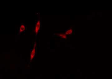 MYST2 / HBO1 Antibody - Staining HeLa cells by IF/ICC. The samples were fixed with PFA and permeabilized in 0.1% Triton X-100, then blocked in 10% serum for 45 min at 25°C. The primary antibody was diluted at 1:200 and incubated with the sample for 1 hour at 37°C. An Alexa Fluor 594 conjugated goat anti-rabbit IgG (H+L) antibody, diluted at 1/600, was used as secondary antibody.