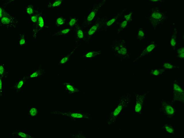 MYST2 / HBO1 Antibody - Immunofluorescence staining of KAT7 in PC3 cells. Cells were fixed with 4% PFA, permeabilzed with 0.1% Triton X-100 in PBS, blocked with 10% serum, and incubated with rabbit anti-Human KAT7 polyclonal antibody (dilution ratio 1:200) at 4°C overnight. Then cells were stained with the Alexa Fluor 488-conjugated Goat Anti-rabbit IgG secondary antibody (green). Positive staining was localized to Nucleus.