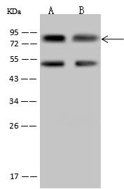MYST2 / HBO1 Antibody - Anti-KAT7 rabbit polyclonal antibody at 1:500 dilution. Lane A: Jurkat Whole Cell Lysate. Lane B: HeLa Whole Cell Lysate. Lysates/proteins at 30 ug per lane. Secondary: Goat Anti-Rabbit IgG (H+L)/HRP at 1/10000 dilution. Developed using the ECL technique. Performed under reducing conditions. Predicted band size: 71 kDa. Observed band size: 75 kDa.
